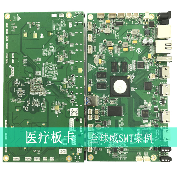 醫(yī)療板卡smt貼片加工-smt來料加工-DIP插件加工